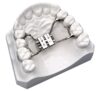 a00676 pre bent rapid palatal expander