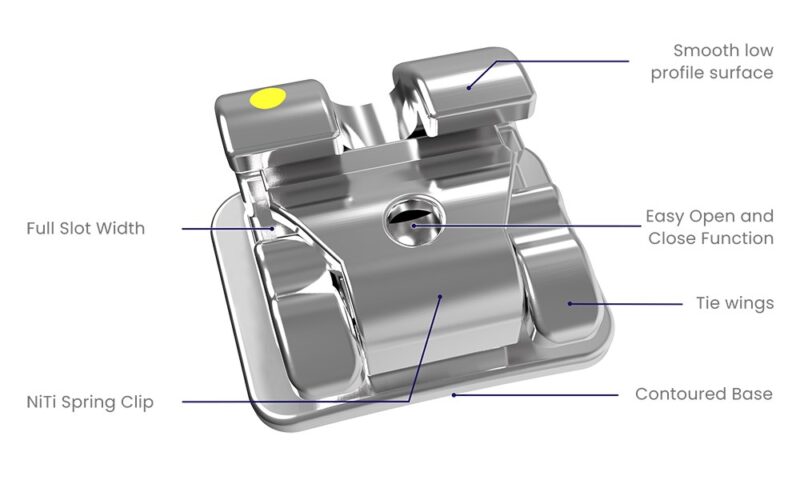 km12102 alpine sl bracket system mbt 022 rx 5 5 kit diagram