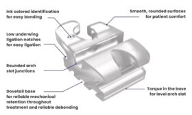 kq08002 signature iii ceramic brackets ricketts bioprogressive rx 3 3 kit diagram